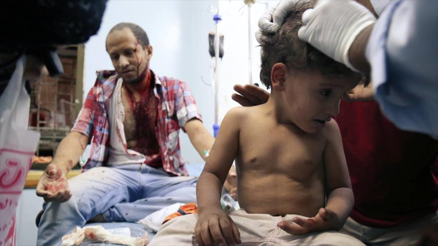 Heridos de la agresión saudí a Yemen.