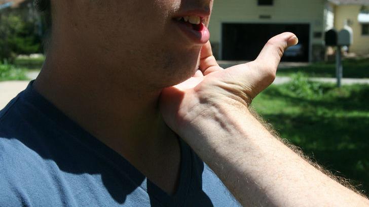 golpes al cuello