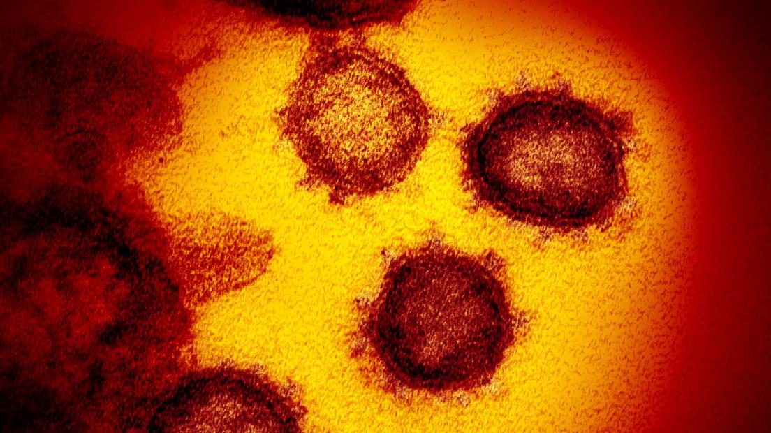 Imágenes en color del nuevo coronavirus.