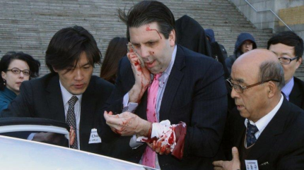 Embajador de EEUU en Corea del Sur es atacado 