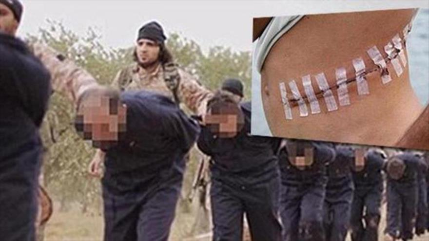 Miembros de Daesh extraen los órganos de sus rehenes y miembros heridos para traficarlos a otros países