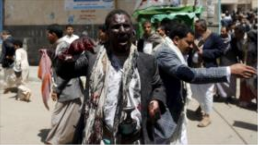 Un chií resulta herido en el atentado terrorista registrado en Yemen. 20 de marzo de 2015