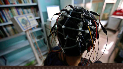 La estimulación eléctrica de cerebro podría combatir la depresión 