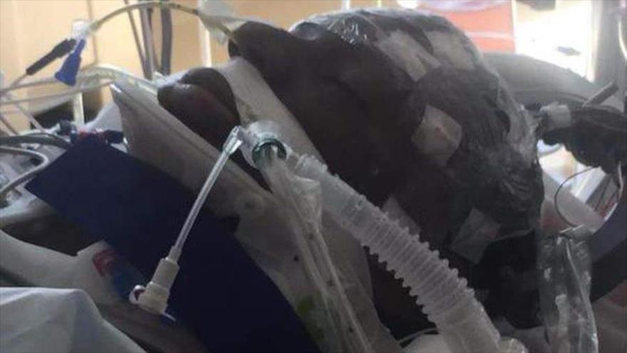 Freddie Gray se encuentra en coma en el hospital tras su arresto