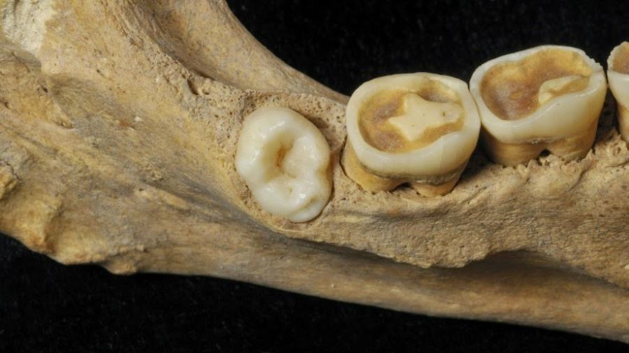 El cuarto molar es el primero por la izquierda.