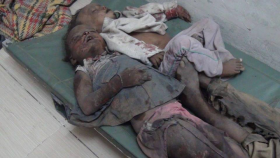 Mueren 5 personas en nuevos bombardeos saudíes en Yemen