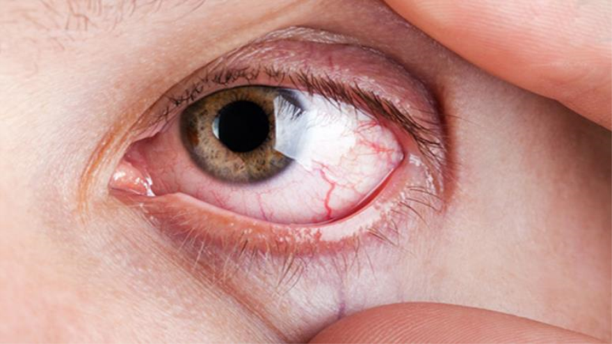 Vasos sanguíneos del ojo "hablan" para | HISPANTV