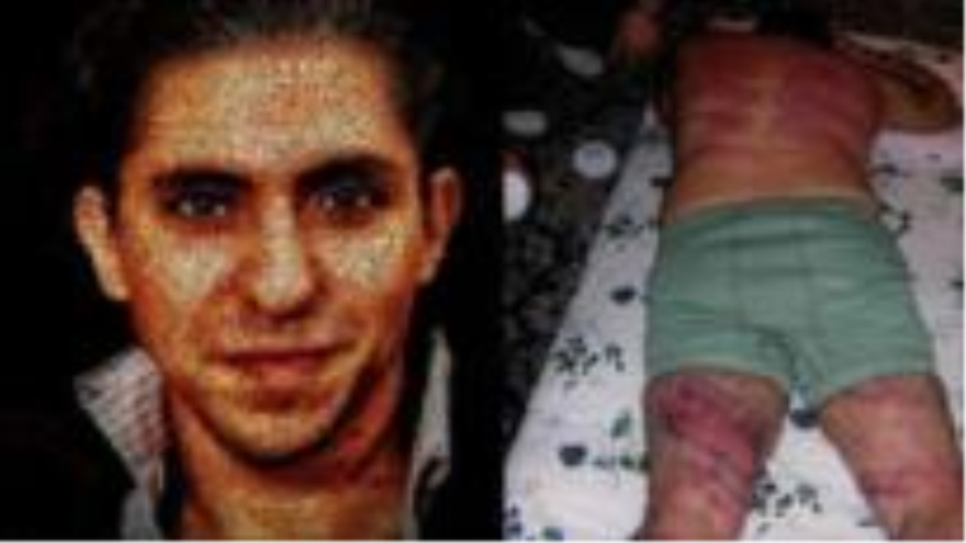 El activista saudí Raef Badawi, que se le infligieron 50 latigazos por apostasía