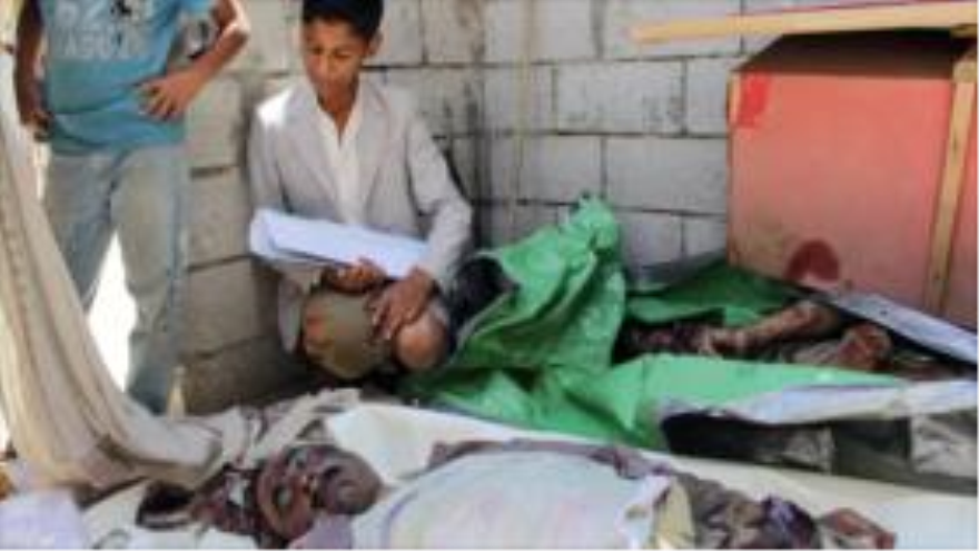 Un niño yemení junto con las victimas de los bombardeos saudíes. 