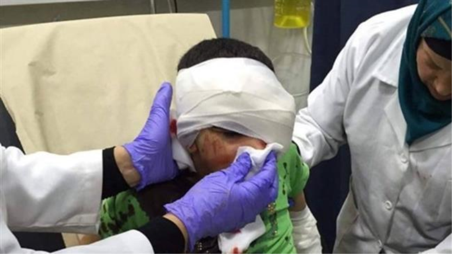 Yashiya Sam al-Amudi, un niño palestino herido de gravedad mientras recibe tratamiento en un hospital. 21 de mayo de 2015.