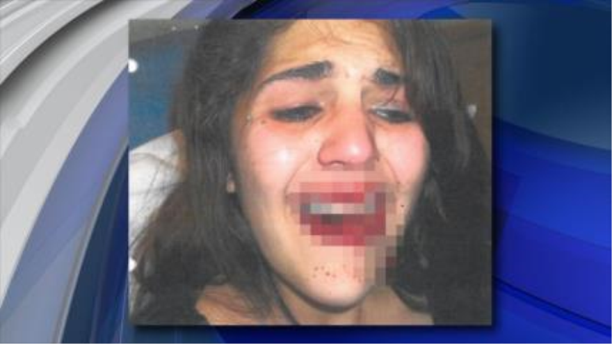 Alexis Acker, de 18 años, resulta herida por la violencia policial.