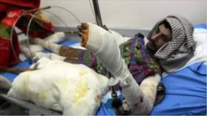 Un hombre yemení herido en los bombardeos saudíes recibe tratamientos en un hospital.