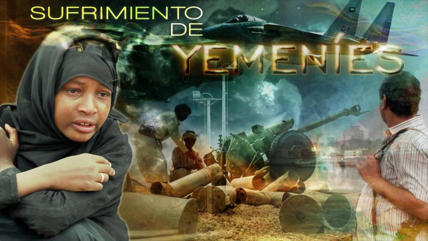Detrás de la Razón - Sufrimiento de yemeníes
