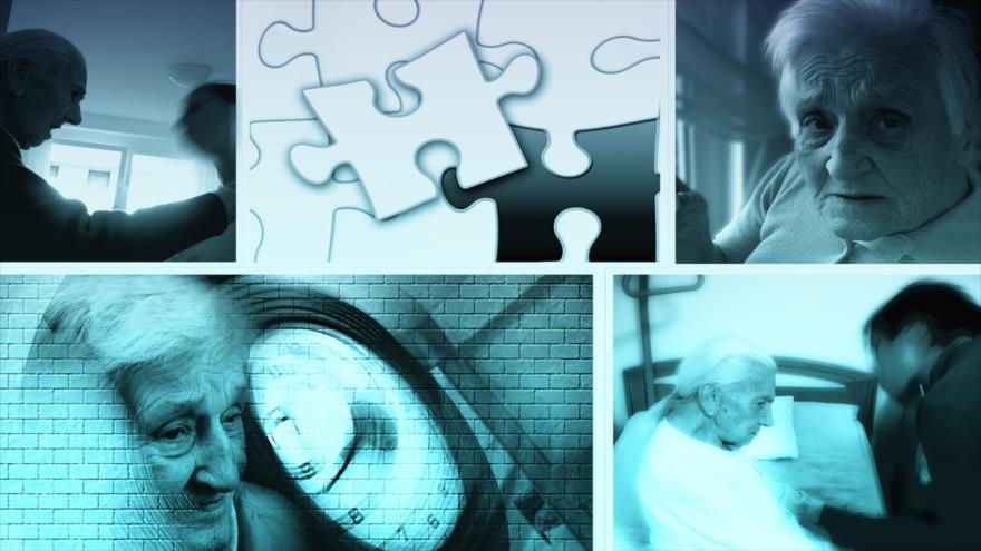 “Ácidos grasos” del cerebro provocan el mal de Alzhéimer, según un nuevo estudio.