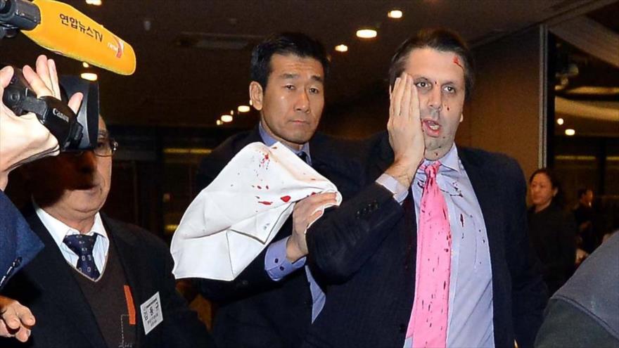 Mark Lippert, embajador de EE.UU. en Corea del Sur, tras ser apuñalado por Kim Ki-jong, en Seúl (capital). 5 de marzo de 2015