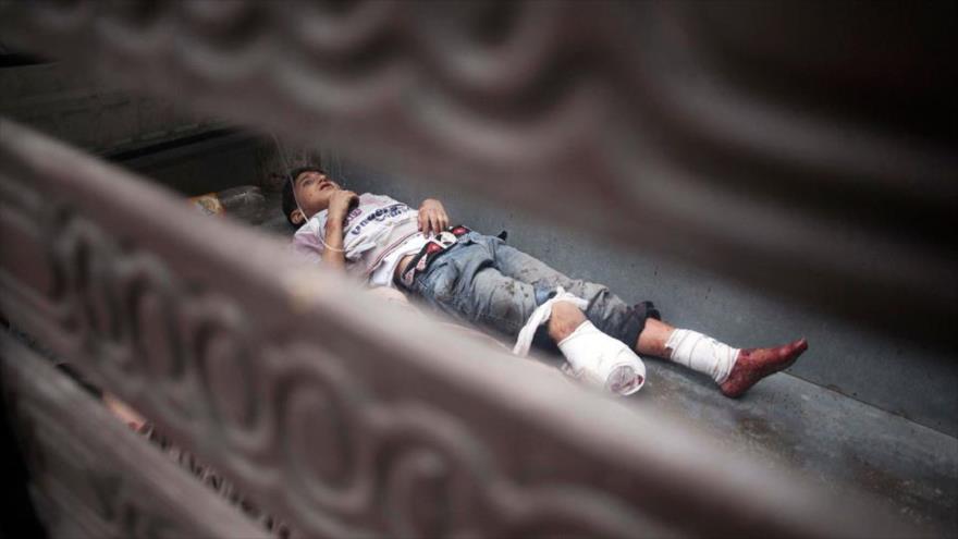Adolescente sirio pierde el pie en los disturbios de la provincia de la provincia de Alepo, noroeste.