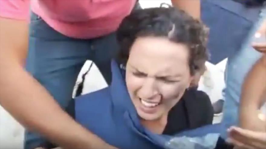 La reportera Hana Mahamid, de la cadena libanesa Al-Mayadeen, tras sufrir en la cara el impacto de una granada de aturdimiento lanzada por las fuerzas israelíes, 5 de octubre de 2015.