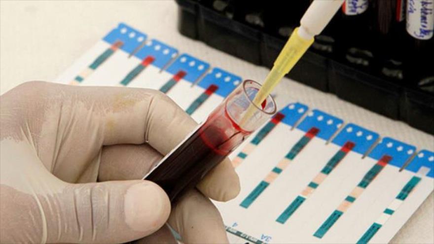 Una prueba de VIH en la sangre.
