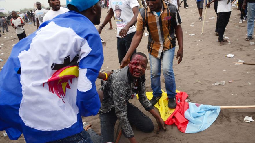 Un manifestante congoleño se incorpora con el rostro ensangrentado tras ser atacado durante una manifestación en Kinshasa (capital), 15 de septiembre de 2015.