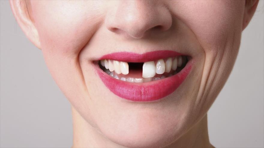 Un estudio demuestra que las personas con menos dientes viven menos.