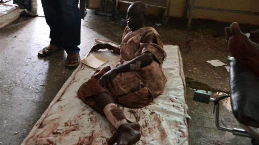 Un víctima de las múltiples explosiones lanzados por terroristas de Boko Haram en Maiduguri, capital del estado Borno, en el noreste de Nigeria. 21 de septiembre de 2015