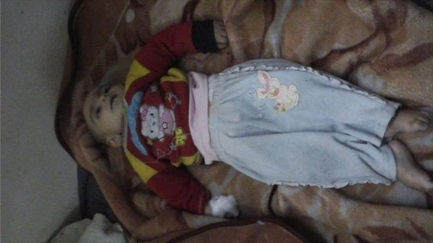 Niña siria de 16 meses pierde la vida por el asedio terrorista a la localidad de Al-Fuah, 13 de enero de 2016.
