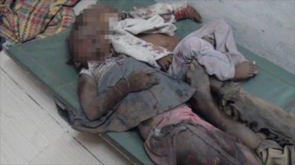 AI pide investigación urgente sobre agresión saudí a Yemen
