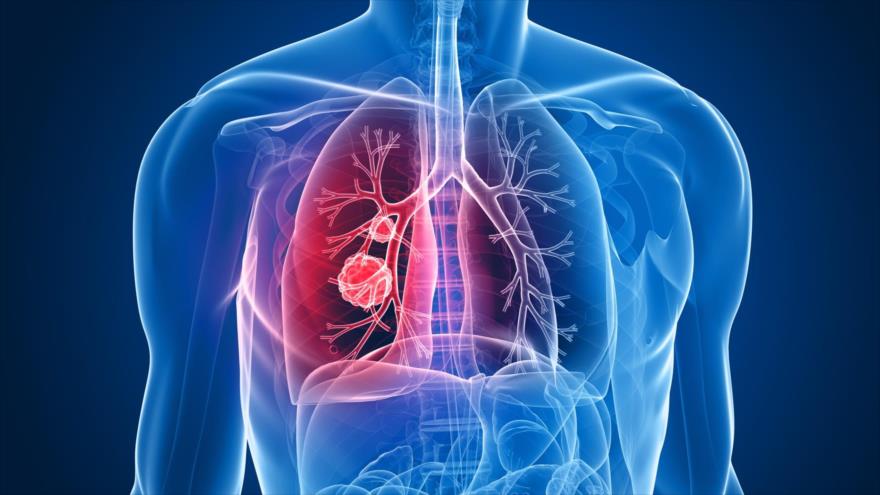Un grupo de científicos logran reducir el cáncer de pulmón más agresivo en modelos preclínicos.