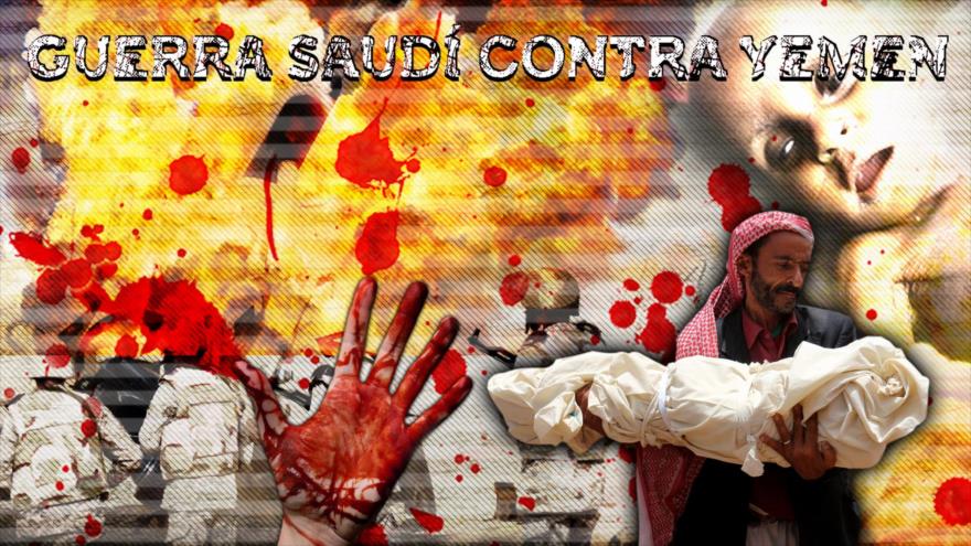 Detrás de la Razón - Armas británicas: lluvia de proyectiles sobre Yemen