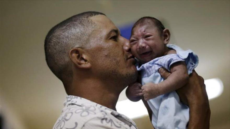 Un bebé con trastorno de microcefalia, que provoca un nacimiento con una cabeza y un cerebro anormalmente pequeños.