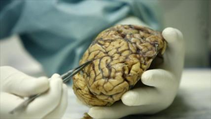 Descubren cómo el cerebro elimina células muertas