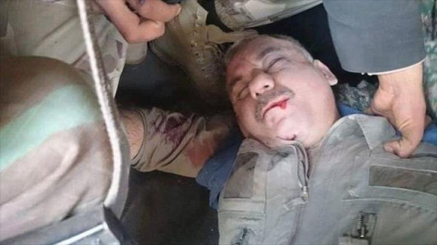 El piloto sirio capturado por el grupo takfirí Frente Al-Nusra, afiliado a Al-Qaeda, tras el derribo de su caza cerca de Alepo.