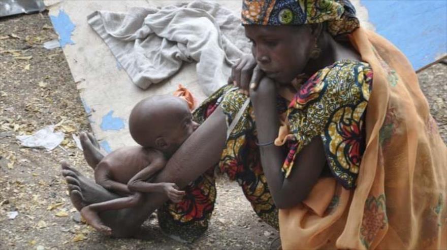 Una imagen desgarradora de una madre y su hijo desnutrido en un campo de desplazados en Bama, en el noreste de Nigeria.