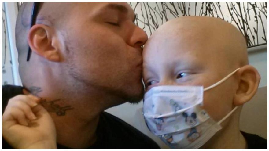 Josh Marshall, el padre que se hizo un tatuaje en la cabeza similar a la cicatriz de su hijo que sufre cáncer de cerebro.