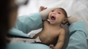 Zika puede afectar a ‘decenas de miles’ de bebés en América Latina