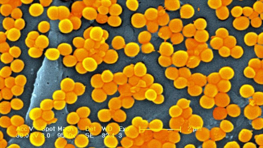 El Staphylococcus aureus ha desarrollado resistencia a varios antibióticos. 
