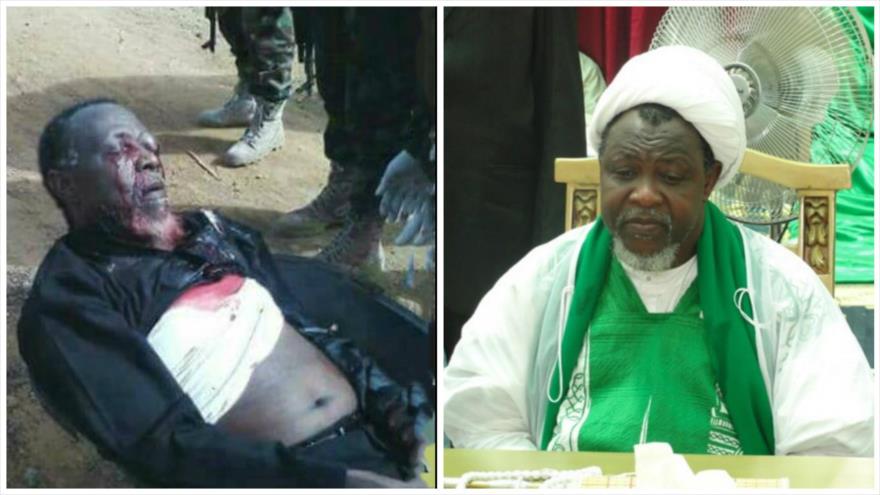 El líder chií en Nigeria, el sheij Ibrahim al-Zakzaky.