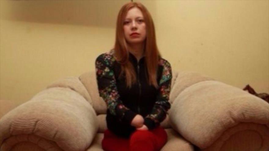 Una mujer pierde manos y pies por negligencia médica en Perú | HISPANTV