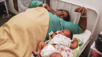 Descubren por qué la obesidad de la madre afecta al bebé