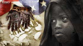 La fachada del sueño americano - Falta de riqueza, falta de salud