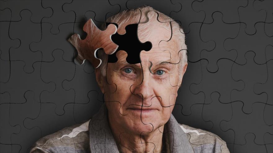 Dieta Occidental aumenta el riesgo de Alzheimer.