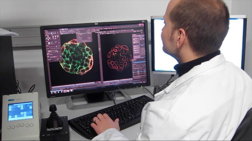 Científicos descubren células que inician metástasis del cáncer | HISPANTV