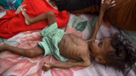 ONU califica catastrófica situación de civiles en Yemen