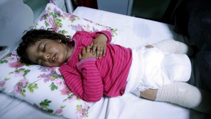 Dima Nadm Hamid, de 3 años de edad, afectada por la posible exposición de armas químicas del grupo terrorista EIIL en Mosul, norte de Irak.