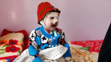 Piden a la ONU incluir a A.Saudí en lista negra por matar a niños