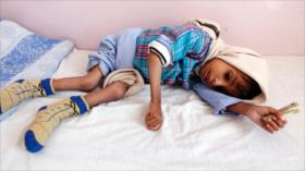 ONU: Un niño menor de 5 años muere cada 10 minutos en Yemen