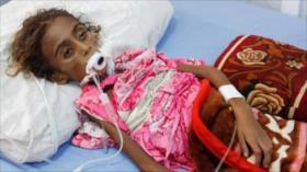 Desgarradoras imágenes: Niña yemení muere por bloqueo saudí