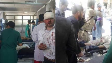 Fuerte explosión deja 80 muertos y 350 heridos en Afganistán