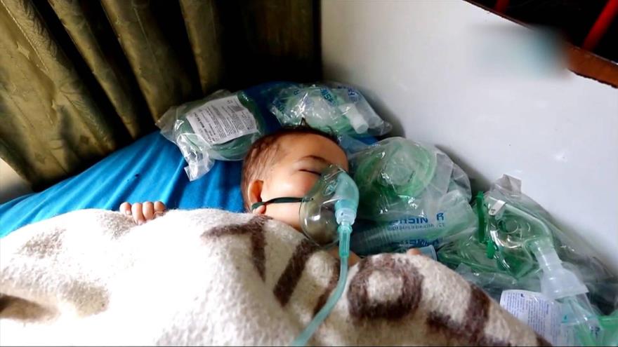 Un niño es atendido en el hospital de Idlib tras un presunto ataque químico en la ciudad siria de Jan Sheijun, 4 de abril de 2017.