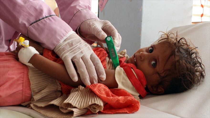 Yemen, víctima de uno de los mayores brotes de cólera